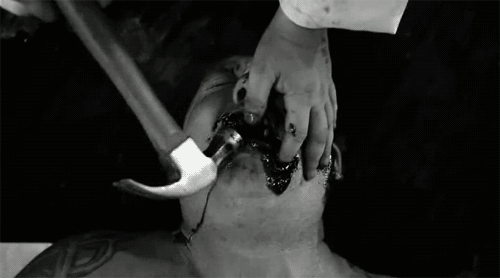 http://static.fjcdn.com/gifs/How+i+feel+at+the+dentist+well+your+gums+bleed_9ff4d0_3874038.gif