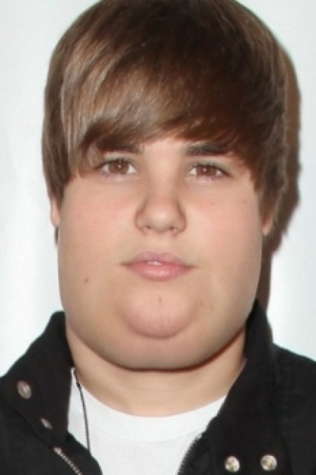 justin bieber obese