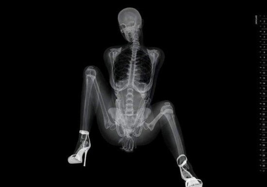 Sexy X Ray