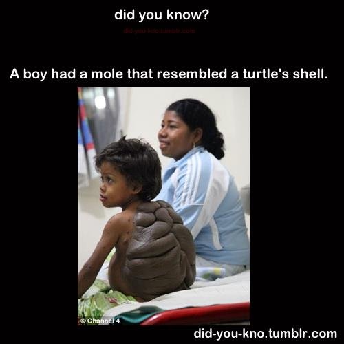 kid turtle