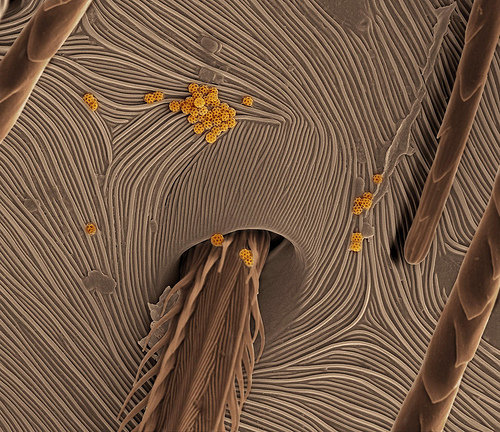 Microscope Split Ends Hair Close Up - Micropedia