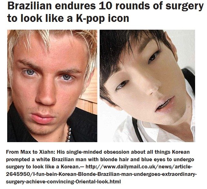 plastic surgery to look asian